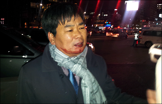 추선희 어버이연합 사무총장이 23일 서울 대한문 앞에서 집회 도중 '한미FTA 반대 촛불집회' 참가자로부터 폭행을 당해 얼굴에서 피를 흘리고 있다.
