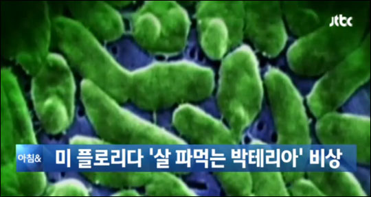30일(현지시각) 미국 현지 언론 등에 따르면 2014년 살 파먹는 박테리아 감염 사례가 11건이 보고됐으며 이들 중 3명이 숨졌다.JTBC 뉴스화면 캡처.