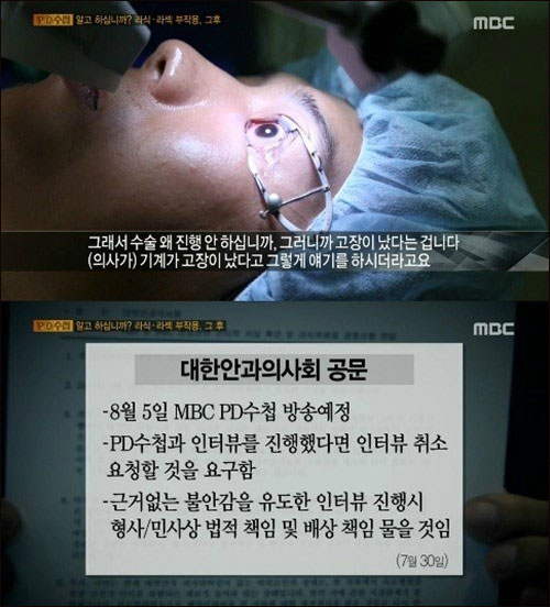 pd수첩 라식 수술 부작용. _MBC 방송화면 캡처