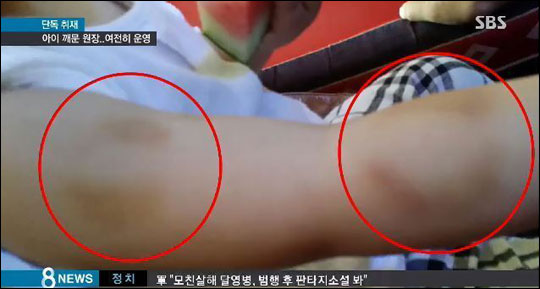 경기도 수원의 한 어린이집 원장이 원생의 팔을 깨물어 상처를 낸 혐의로 기소됐다. SBS 화면 캡처