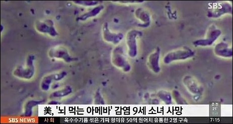 일본 식인박테리아 초비상. SBS뉴스 화면 캡처
