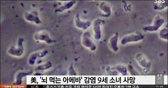 일본 '산케이 신문'은 지난 2일 "8월 23일까지 식인 박테리아로 인한 감염자가 291명에 이르며, 사망자는 올 6월까지 71명에 달한다"고 보도했다. 사진은 SBS 뉴스화면 캡처 