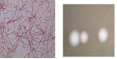 (왼쪽)0.05% basic fuchsin으로 염색한 레지오넬라균 (1,000배), (오른쪽)해부현미경으로 관찰한 레지오넬라균 집락사진(100배).ⓒ연합뉴스