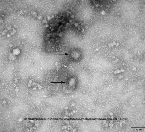 질병관리본부가 제공한 전자현미경을 통해 본 중국 우한 코로나바이러스 이미지. ⓒ질병관리본부