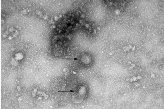 현미경으로 확대한 코로나바이러스 모습. 표면에 돌기가 형성돼있어 왕관 모양을 하고 있다. ⓒ질병관리본부