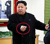 북한 김정은, 지난 해 발목 이어 이번엔 '손목 부상'