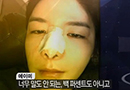 에이미, 쇼크 상태로 긴급후송 "머리 구타당한 게 원인"