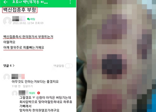 "부항 뜨세요, 코로나 백신 빼내는 방법입니다" 황당글 논란