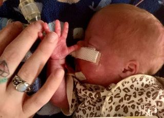 22주 만에 태어난 500g 미숙아, 미국 의료진이 '지퍼백'으로 살렸다