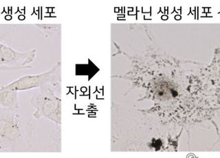 LG생활건강, 한국인 피부 색소 침착 유전자 발견…특허 출원