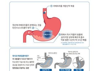 대웅테라퓨틱스, 위식도역류질환 '라베프라졸' 개량신약 출시