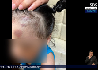 생후 20개월 폭행한 어린이집 교사 "수저와 책으로 머리를…"
