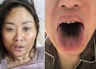 기괴해진 얼굴, 검은 혓바닥…신종 돌연변이 증상에 난리 난 중국
