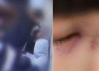 "나 밀길래 한 대 쳤다" 주먹으로 중학생 코뼈 부러뜨린 학원강사