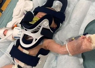 3주된 신생아, 파울볼 맞고 두개골 골절…부모는 경악