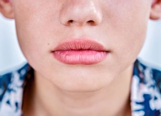 찬바람에 갈라지고 벗겨지는 내 입술…‘구순염’ 어떤 질환?