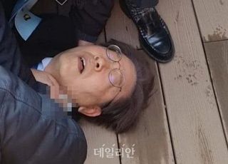 이재명, 서울대병원으로 이송한 까닭은…부산대 "가족 요청 때문"