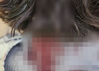 배현진, 병상서 피해자 진술 및 피묻은 옷가지 제출…"처벌해 달라"