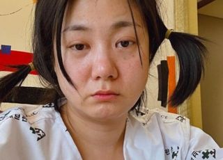 박나래, 성대 수술 받았다…“꾀꼬리로 진화 중”