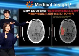 SK C&amp;C, 뇌경색 진단 AI 솔루션 식약처 허가 획득
