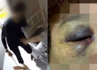 "지적장애 엄마, 20대 男보호사에게 구타 당하고는…"