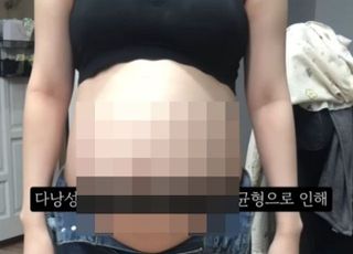 경찰, '36주 낙태' 영상 관련 유튜브 압수수색…"게시자 특정될 것"