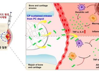 아주대 연구팀, 류마티즘 등 자가면역질환 치료 효율 높일 신기술 개발