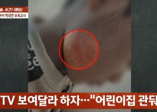 '뇌종양 3세' 학대 어린이집…CCTV 요구에 "우릴 못 믿는 것"