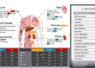 경기도 지원 성균관대, ‘안저영상 AI 분석 기술’확보…고품질 의료진단 서비스 기대