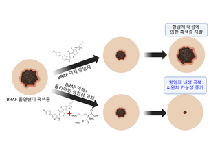 KIST, 새 흑색종 항암제 개발 전략 제시…	“내성 발성 억제”