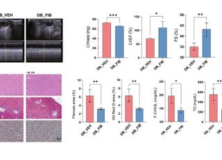 GIST, 고지혈증 치료제인 ‘페노피브레이트’ 비만·당뇨로 인한 심부전 예방 효과 입증