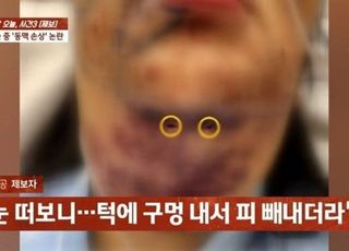 지방흡입 시술 받고 턱 뚫린女…의사 "안 죽어" 나몰라라 대응