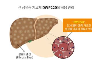 대웅제약, 중증 간 섬유증 ‘경구용 신약’ 개발 속도