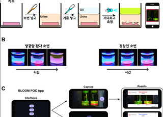 KIST, 소변용 방광암 진단키트 개발…민감도 88.8% 달해