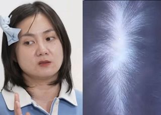 [데일리 헬스] 박나래, 스트레스 많고 수면시간 부족…"30·40대 女탈모 원인은 '이것'"