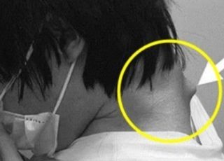 목이 앞으로 90도 꺾였다…‘이거’ 장시간 본 男 사례에 ‘충격’