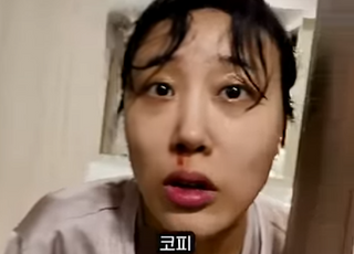 [데일리 헬스] ‘쌍둥이 임신’ 임라라, 세수 중 코피...임신 초기 증상 보니