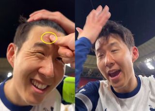 손흥민 이마에 없었던 흉터가? “누가 밀어서…”
