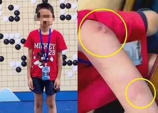 "父, 경기질 때마다 폭행" 9세 바둑천재 극단적 선택, 무슨 일?
