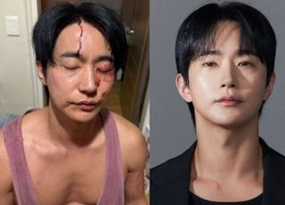 전호준, 전 연인 폭행 의혹에 “자택 침입에 불가피한 충돌…정당방위”