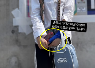 이채연 ‘파란’ 아대+‘빨간’ 방울토마토 함께…정치색 논란 피했다