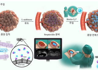 KIST, 암 조직 실시간 식별하는 형광 박테리아 수술 기술 개발