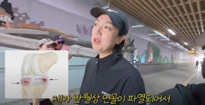 [데일리 헬스] "만삭 때부터 아파" 이은형, 심각한 건강 상태 공개...원인은 '이 질환'