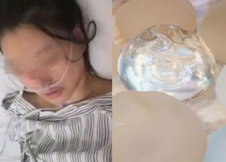 '가슴 보형물 덕분에' 흉기에 수십번 찔리고도 목숨 구한 女