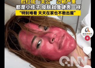 [영상] “22년간 화장 안 지웠다”…그 결과는 ‘충격’