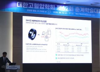 대웅제약, 최신 반지형 혈압계 '카트 온' 출시 예고…5대 바이탈 통합 모니터링
