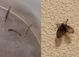 “토하면 살아있는 벌레가...” 8살 소녀 뱃속에 있던 것은?