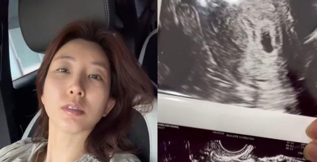 [데일리 헬스] '계류 유산' 소식 전한 박인영...출산 후만큼 중요한 '유산 후 몸조리' 어떻게?