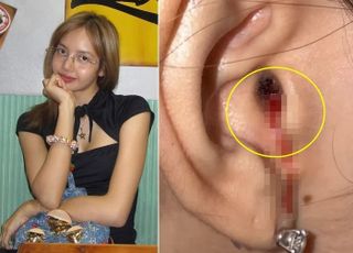 [데일리 헬스] 귀에서 피 흐른 ‘이 女가수’...출혈 이유는? “위험 신호일 수도”