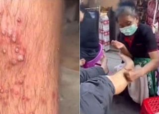 "동남아서 값싼 마사지 받다가…" 경악스러운 경험담 나왔다
